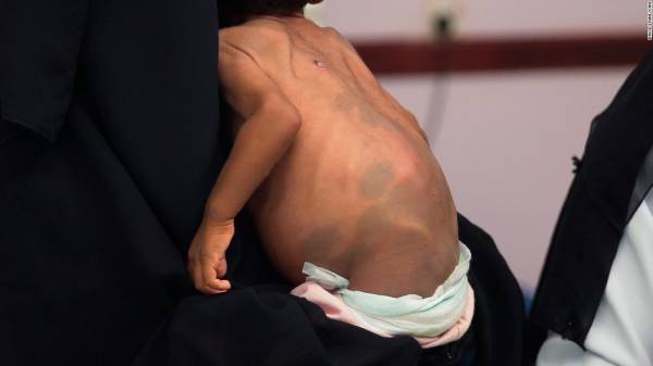 في تقرير استقصائي لشبكةCNNالإخبارية: الحوثيون يسرقون الطعام من أفواه الجياع..! - (تفاصيل شاملة)