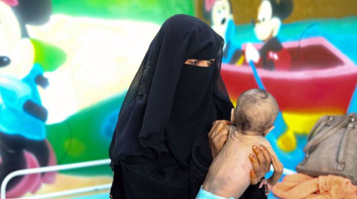 وسط أنباء عن توزيع أغذية خطرة على الأطفال.. خبير اقتصادي: التحذيرات الدولية من "الجوع" في اليمن حقيقة واقعة