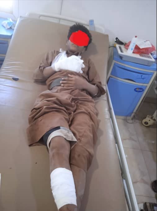 إصابة طفل بانفجار لغم من مخلفات عصابة الحوثي بمخيم للنازحين بمآرب
