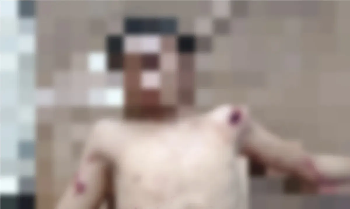 لغم حوثي يمزق جسد طفل في حيس.. إرهاب الألغام يطارد المدنيين ويحاصر حياة السكان