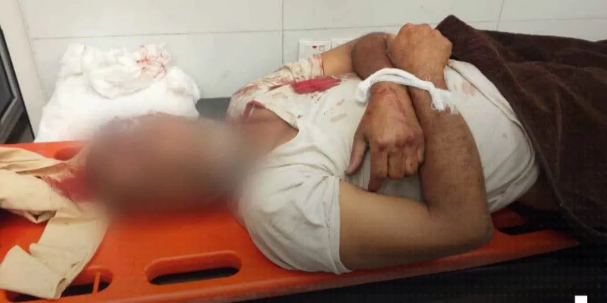 استشهاد مسن بقصف حوثي على حي سكني يكشف حجم الجرائم المنظمة ضد أبناء تعز
